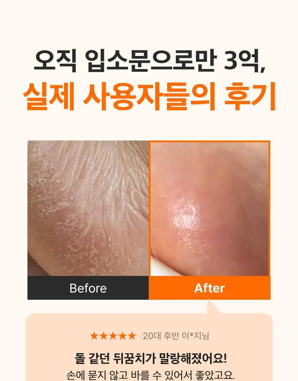 [데일리풋케어/맨들맨들아기발] 성분에디터 시어버터 베이비 풋 스틱 20g 2종 택 1 상세페이지 39